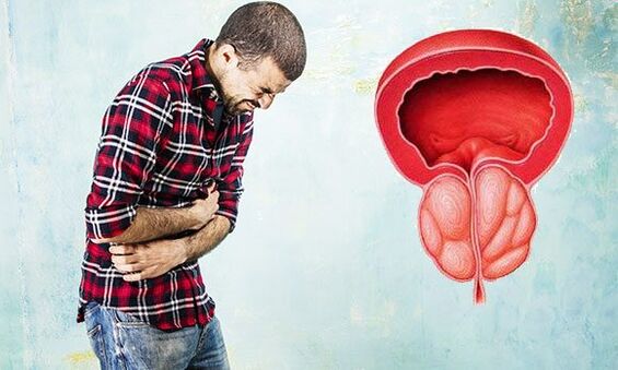 symptoms of prostatitis in men